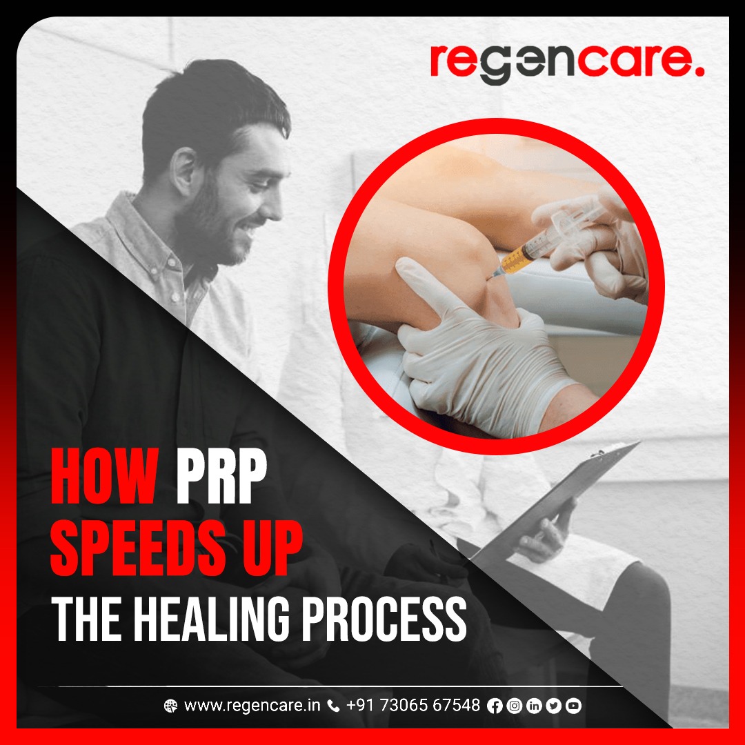 How PRP treatment speeds up the healing process - Regencare, Kochi