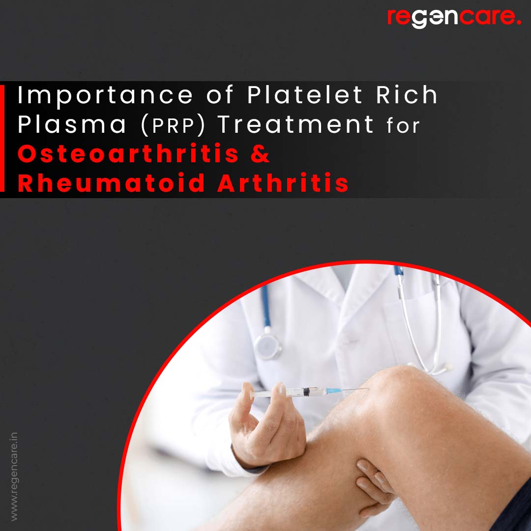 Importance of Platelet Rich Plasma (PRP) treatment for Osteoarthritis and Rheumatoid Arthritis