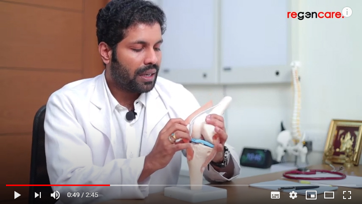 Regenerative Medicine for Osteoarthris in Kochi - Regencare