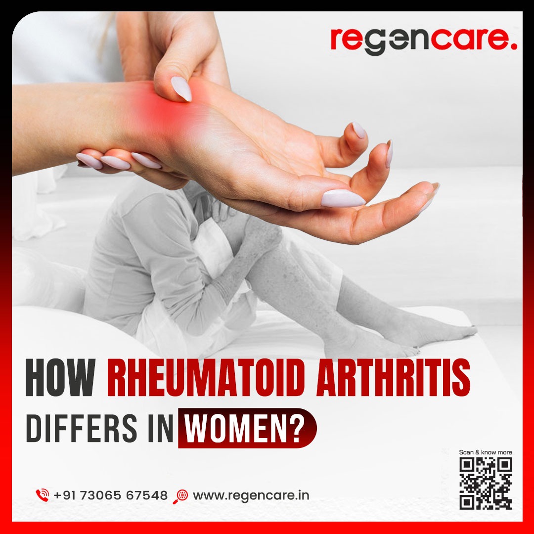 How Rheumatoid Arthritis Differs in Women | PRP for Rheumatoid Arthritis