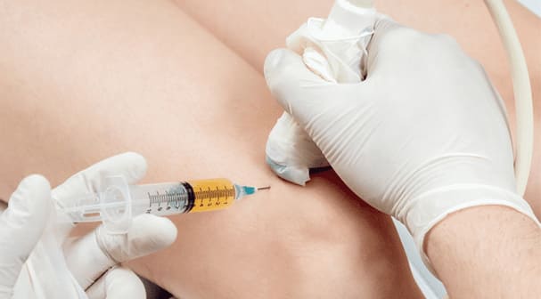 prp injection for knee