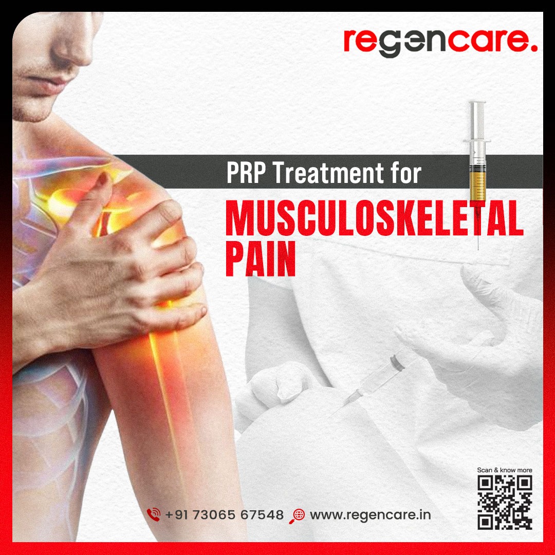 PRP Injections Can Be An Effective Treatment For Musculoskeletal Pain.