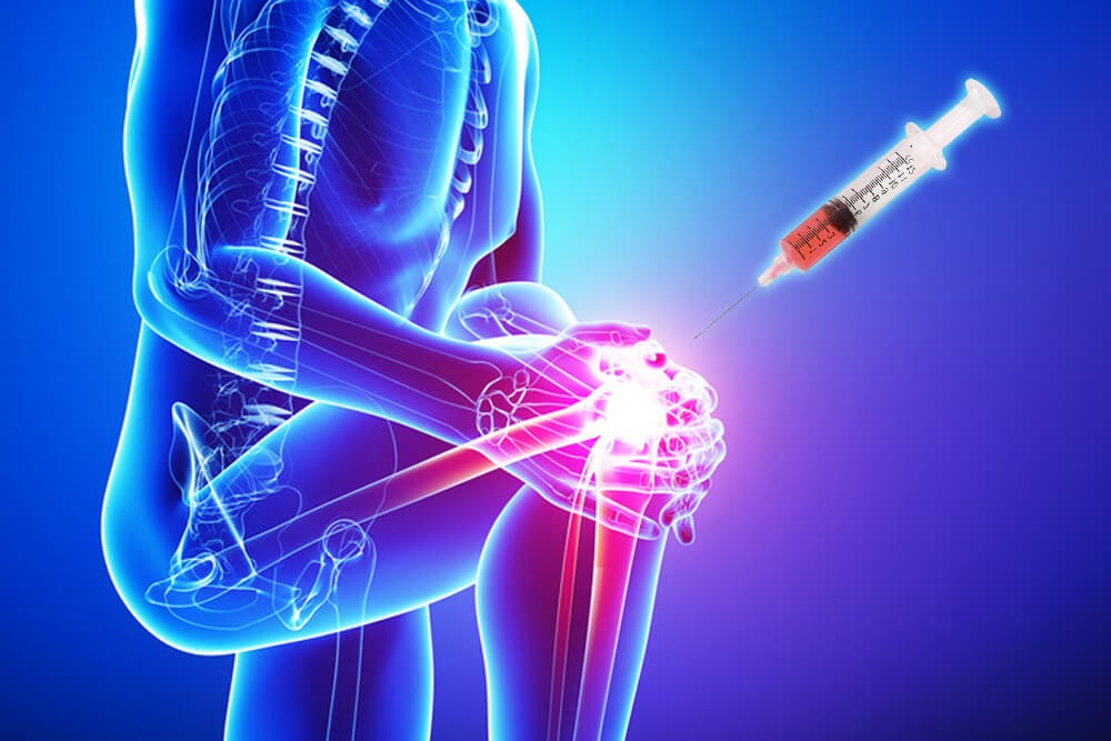 Joint Pain And Osteoarthritis PRP Treatment in Kochi - Regencare