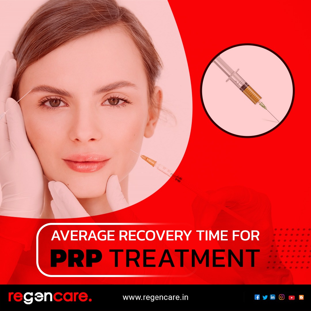 Average recovery time for PRP treatment - Regencare